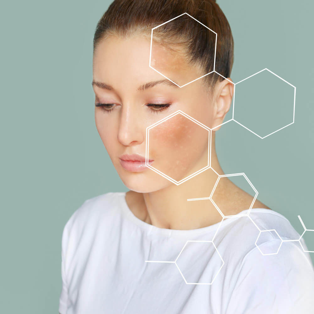 Dermatogenetičko testiranje i personalizovana nega ključ za zdravlje vaše kože, a ne trend! (2)